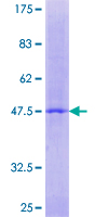 RERGL / FLJ22655 Protein - 12.5% SDS-PAGE of human FLJ22655 stained with Coomassie Blue