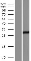RESP18 Protein - Western validation with an anti-DDK antibody * L: Control HEK293 lysate R: Over-expression lysate