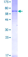 RET Protein - 12.5% SDS-PAGE of human RET stained with Coomassie Blue