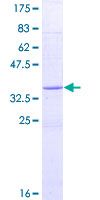 RETN / Resistin Protein - 12.5% SDS-PAGE of human RETN stained with Coomassie Blue