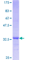 RETN / Resistin Protein - 12.5% SDS-PAGE Stained with Coomassie Blue.