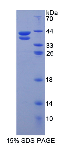 RETNLB / RELM-Beta Protein - Recombinant  Resistin Like Beta By SDS-PAGE