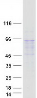RETSAT Protein - Purified recombinant protein RETSAT was analyzed by SDS-PAGE gel and Coomassie Blue Staining