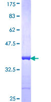 REV1 Protein - 12.5% SDS-PAGE Stained with Coomassie Blue.