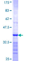 REV3L / REV3 Protein - 12.5% SDS-PAGE Stained with Coomassie Blue.