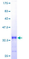 REXO2 Protein - 12.5% SDS-PAGE of human DKFZP566E144 stained with Coomassie Blue