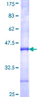 REXO2 Protein - 12.5% SDS-PAGE Stained with Coomassie Blue.