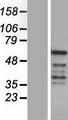 REXO4 / MPMC2 Protein - Western validation with an anti-DDK antibody * L: Control HEK293 lysate R: Over-expression lysate