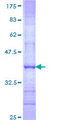 REXO4 / MPMC2 Protein - 12.5% SDS-PAGE Stained with Coomassie Blue.