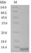RFC1 / RFC Protein - (Tris-Glycine gel) Discontinuous SDS-PAGE (reduced) with 5% enrichment gel and 15% separation gel.