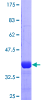 RFC1 / RFC Protein - 12.5% SDS-PAGE Stained with Coomassie Blue.