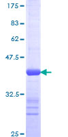 RFC2 / RFC40 Protein - 12.5% SDS-PAGE Stained with Coomassie Blue.
