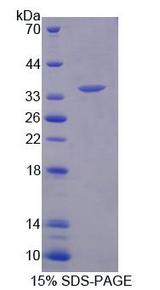 RFC2 / RFC40 Protein - Recombinant Replication Factor C2 (RFC2) by SDS-PAGE