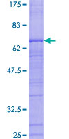 RFC3 Protein - 12.5% SDS-PAGE of human RFC3 stained with Coomassie Blue