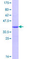 RFC4 Protein - 12.5% SDS-PAGE Stained with Coomassie Blue.