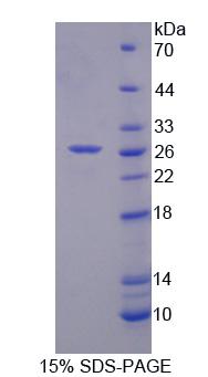 RFC4 Protein - Recombinant Replication Factor C4 (RFC4) by SDS-PAGE