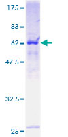 RFC5 Protein - 12.5% SDS-PAGE of human RFC5 stained with Coomassie Blue