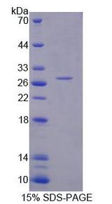 RFC5 Protein - Recombinant Replication Factor C5 (RFC5) by SDS-PAGE