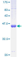 RFK Protein - 12.5% SDS-PAGE of human RFK stained with Coomassie Blue