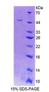 RFK Protein - Recombinant Riboflavin Kinase By SDS-PAGE