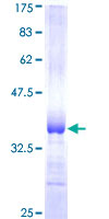 RFPL1 Protein - 12.5% SDS-PAGE Stained with Coomassie Blue.