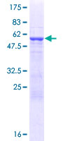 RFPL3 Protein - 12.5% SDS-PAGE of human RFPL3 stained with Coomassie Blue