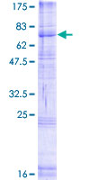 RFT1 Protein - 12.5% SDS-PAGE of human RFT1 stained with Coomassie Blue