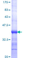 RFT1 Protein - 12.5% SDS-PAGE Stained with Coomassie Blue.