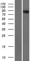 RFTN1 / Raftlin Protein - Western validation with an anti-DDK antibody * L: Control HEK293 lysate R: Over-expression lysate