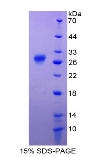 RFTN1 / Raftlin Protein - Recombinant Raft Linking Protein By SDS-PAGE