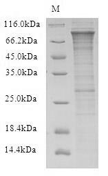 RFWD2 / COP1 Protein - (Tris-Glycine gel) Discontinuous SDS-PAGE (reduced) with 5% enrichment gel and 15% separation gel.