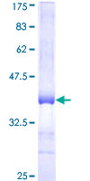 RFWD2 / COP1 Protein - 12.5% SDS-PAGE Stained with Coomassie Blue.