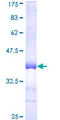 RFWD2 / COP1 Protein - 12.5% SDS-PAGE Stained with Coomassie Blue.