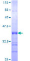 RFWD3 Protein - 12.5% SDS-PAGE Stained with Coomassie Blue.