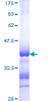 RFX / RFX1 Protein - 12.5% SDS-PAGE Stained with Coomassie Blue.