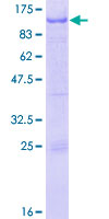 RFX2 Protein - 12.5% SDS-PAGE of human RFX2 stained with Coomassie Blue