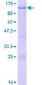 RFX2 Protein - 12.5% SDS-PAGE of human RFX2 stained with Coomassie Blue