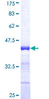 RFX5 Protein - 12.5% SDS-PAGE Stained with Coomassie Blue.