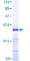 RFX5 Protein - 12.5% SDS-PAGE Stained with Coomassie Blue.