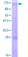 RFX6 Protein - 12.5% SDS-PAGE of human RFXDC1 stained with Coomassie Blue