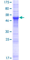 RFXANK Protein - 12.5% SDS-PAGE of human RFXANK stained with Coomassie Blue