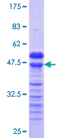 RFXANK Protein - 12.5% SDS-PAGE Stained with Coomassie Blue.