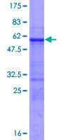 RFXAP Protein - 12.5% SDS-PAGE of human RFXAP stained with Coomassie Blue