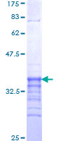RFXAP Protein - 12.5% SDS-PAGE Stained with Coomassie Blue.