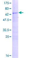 RG9MTD3 Protein - 12.5% SDS-PAGE of human RG9MTD3 stained with Coomassie Blue