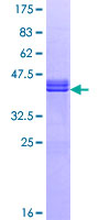 RGCC Protein - 12.5% SDS-PAGE of human RGC32 stained with Coomassie Blue