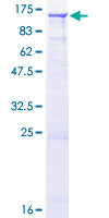 RGL1 / RGL Protein - 12.5% SDS-PAGE of human RGL1 stained with Coomassie Blue