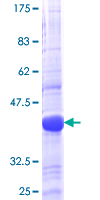 RGL1 / RGL Protein - 12.5% SDS-PAGE Stained with Coomassie Blue.