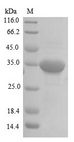 RGMA Protein - (Tris-Glycine gel) Discontinuous SDS-PAGE (reduced) with 5% enrichment gel and 15% separation gel.
