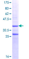 RGMA Protein - 12.5% SDS-PAGE Stained with Coomassie Blue.